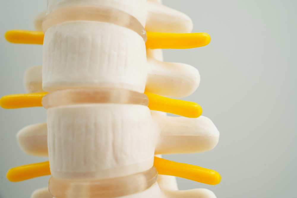 Degenerative Disc Disease  Burbank, CA