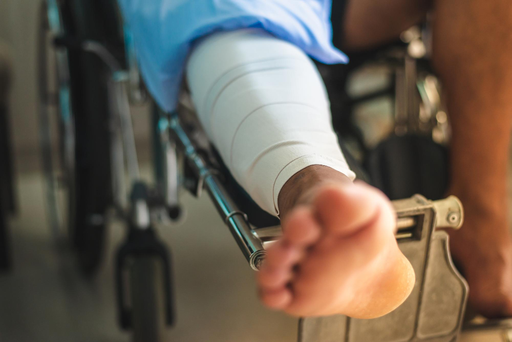 Personal Injury  Burbank, CA